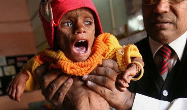 india-starving-baby.jpg